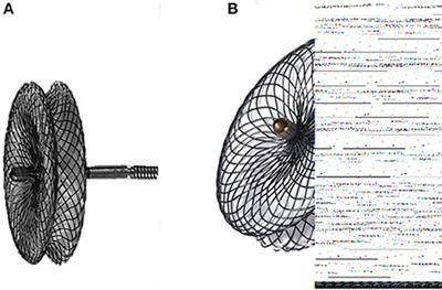 Long-Term Outcome of Transcatheter Device Closure of Perimembranous Ventricular Septal Defects